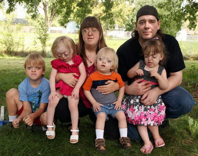 Синдром крузона семья с тремя детьми